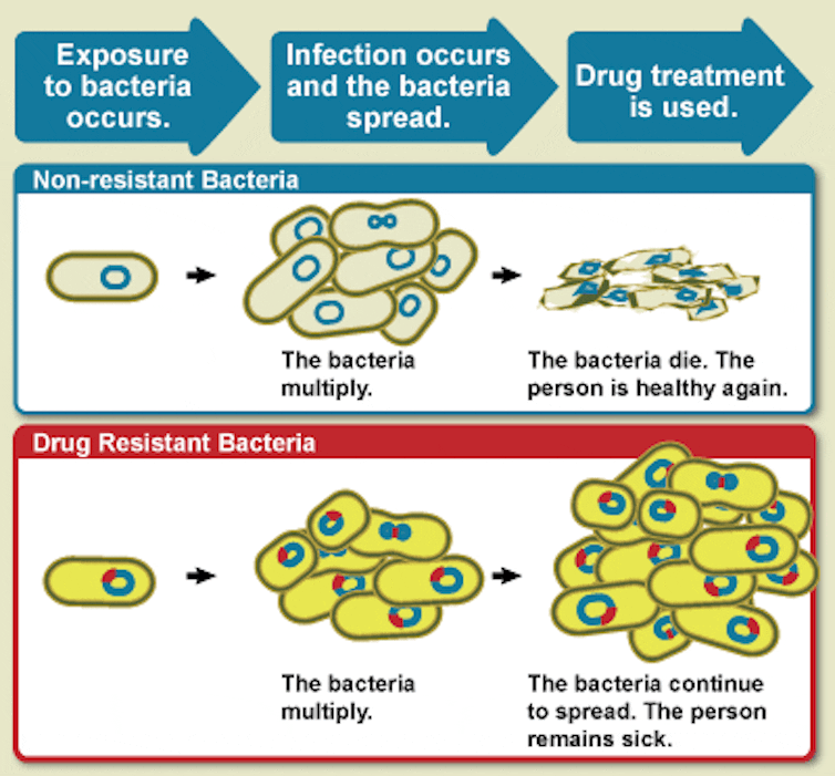 Infografikë që tregon se si trajtimet me antibiotikë bëhen joefektive kundër bakterieve rezistente.