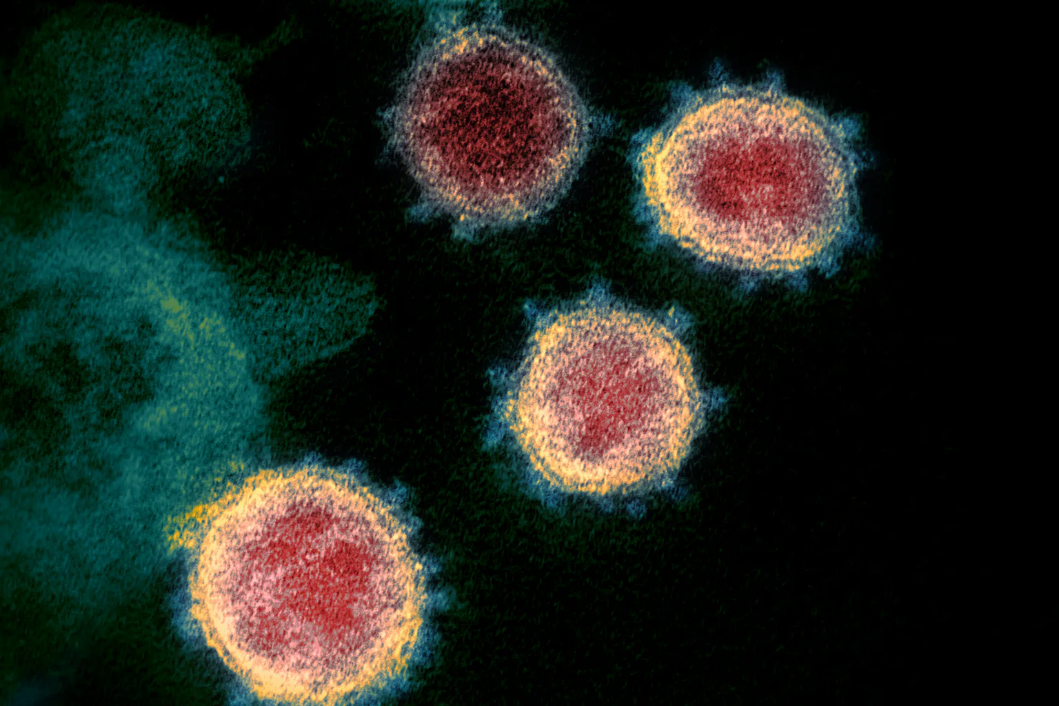 Long-COVID, viruses and ‘zombie’ cells: new research looks for links to ...