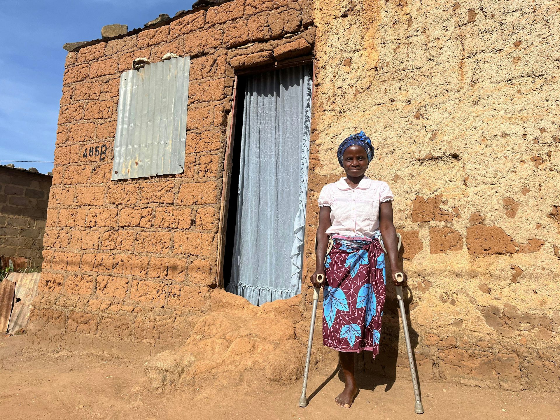 A young woman who has lost her leg in a landmine incident stands outside her hut in Angola.