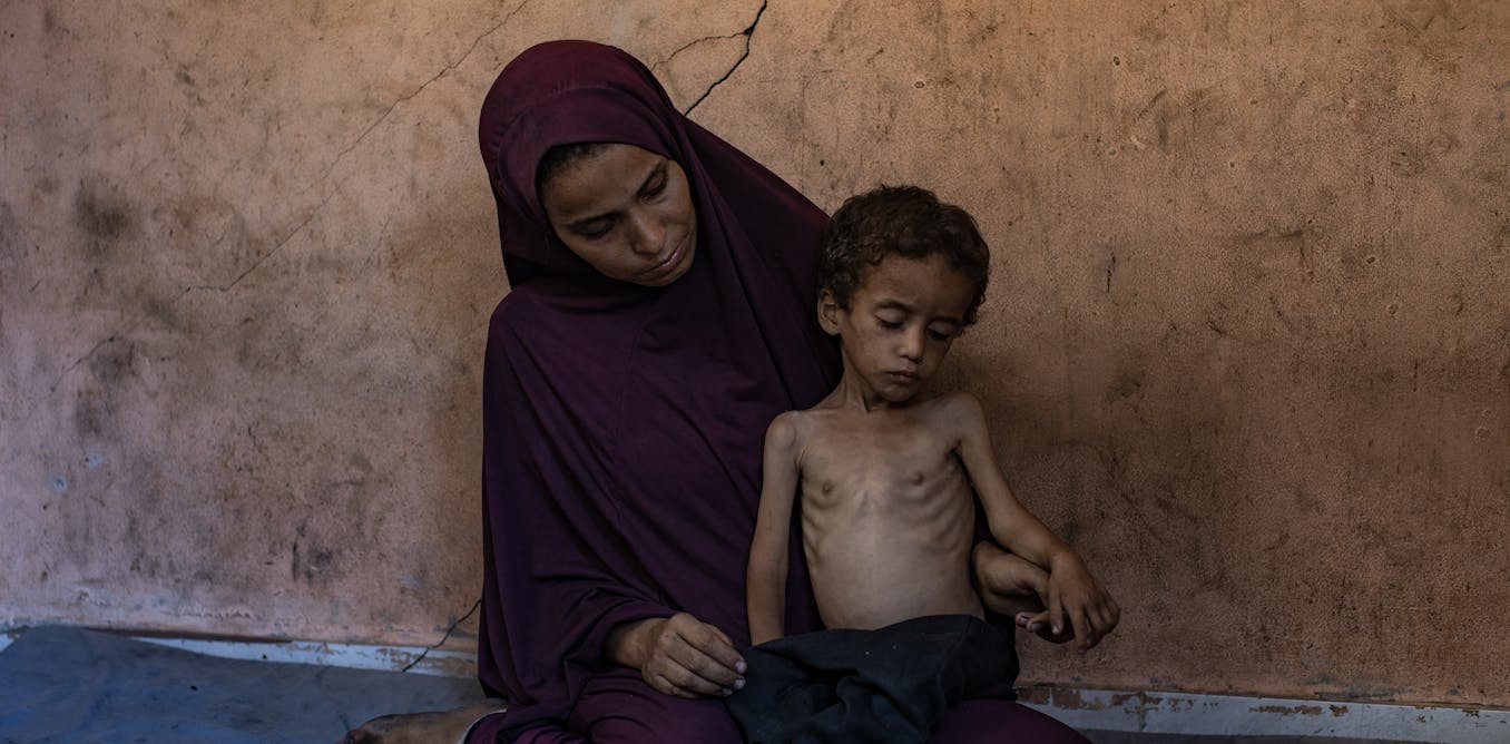 Gaza Is Starving – How Israel’s Allies Can Go Beyond Words and Take Meaningful Action Gaza Is Starving – How Israel’s Allies Can Go Beyond Words and Take Meaningful Action