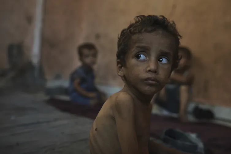 A dark haired malnourished two year old boy sitting with other children
