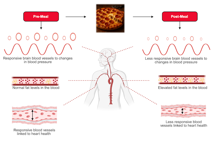 Un'illustrazione che raffigura arterie rigide e un cervello lento.