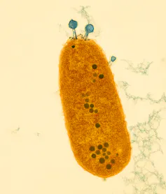 A bacterium (orange) being attacked by phages (black dots).