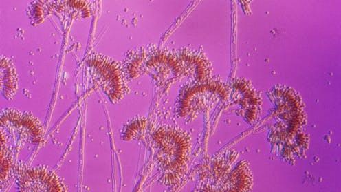 Are you really allergic to penicillin? A pharmacist explains why there’s a good chance you’re not − and how you can find out for sure