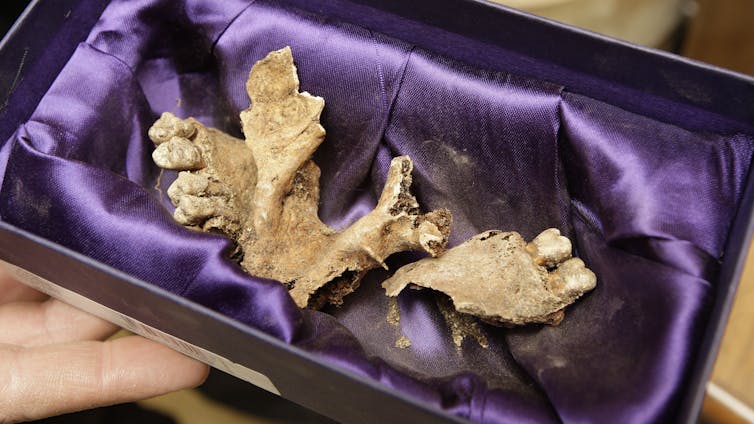 Fragments of bones shown in container lined with purple satin