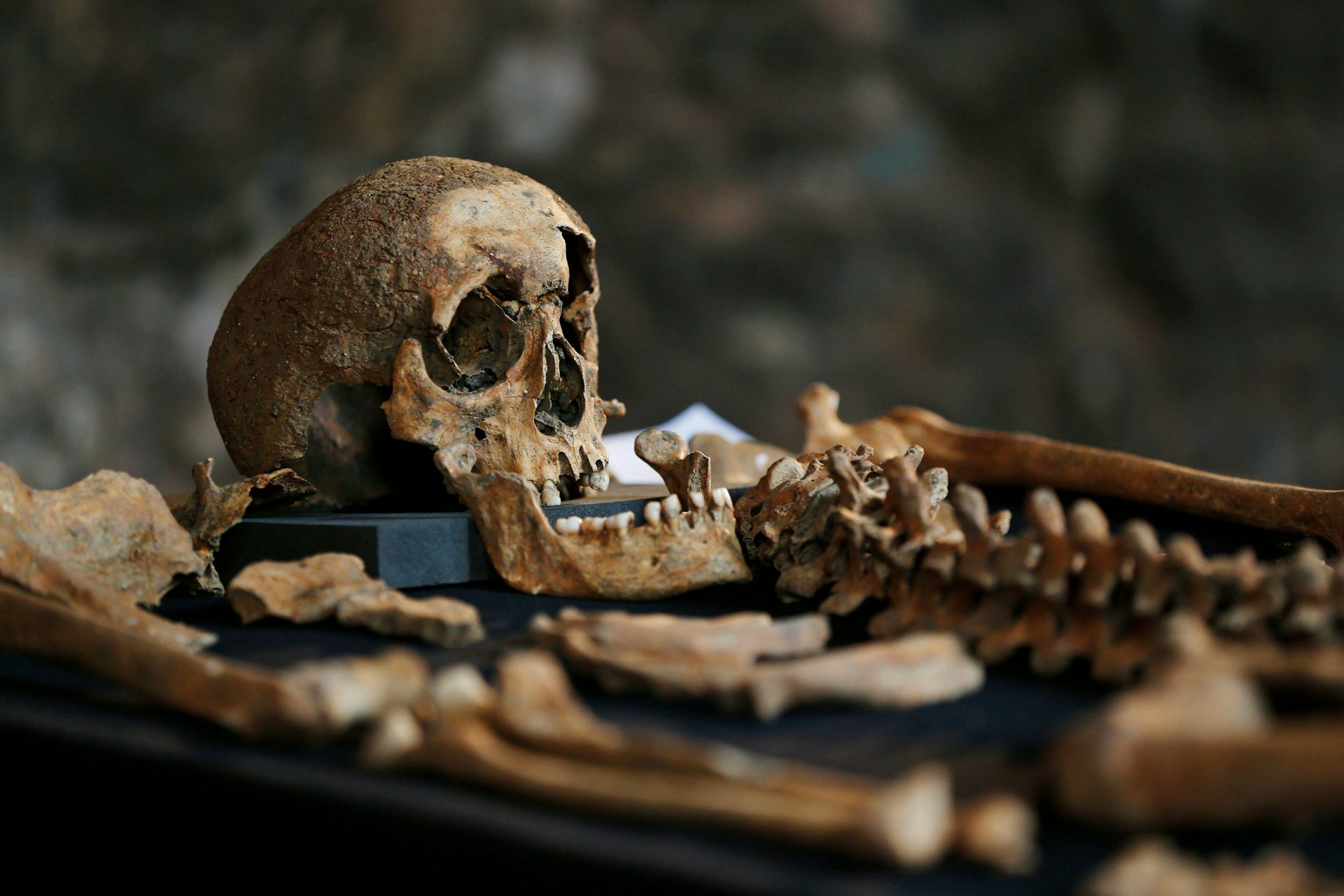 A skeleton from a Black Death burial site in Charterhouse Square, London.