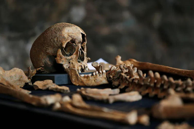 A skeleton from a Black Death burial site in Charterhouse Square, London.