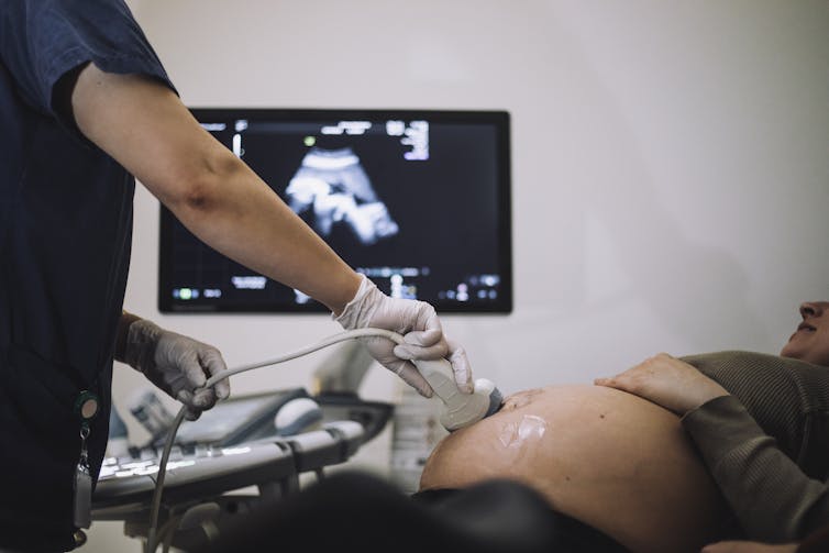 Gynecologist doing an ultrasound on a pregnant woman in a clinic.