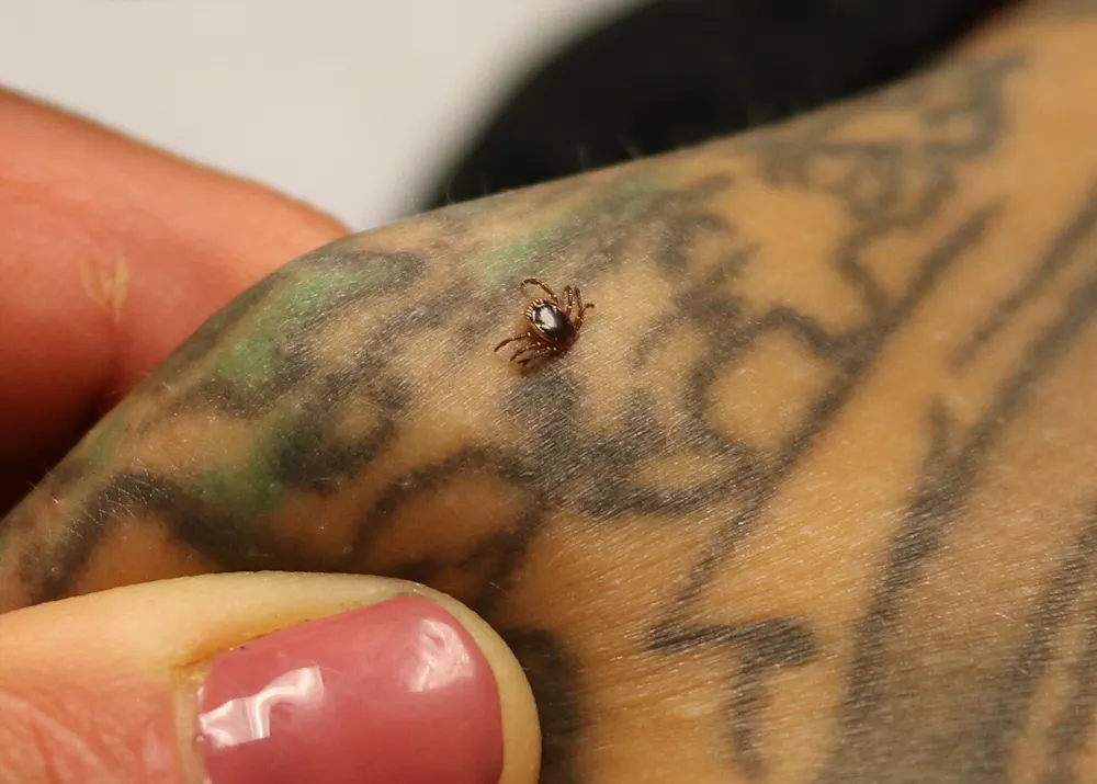 Star Rash Tick A red meat allergy from tick bites is spreading – and the lone star ...