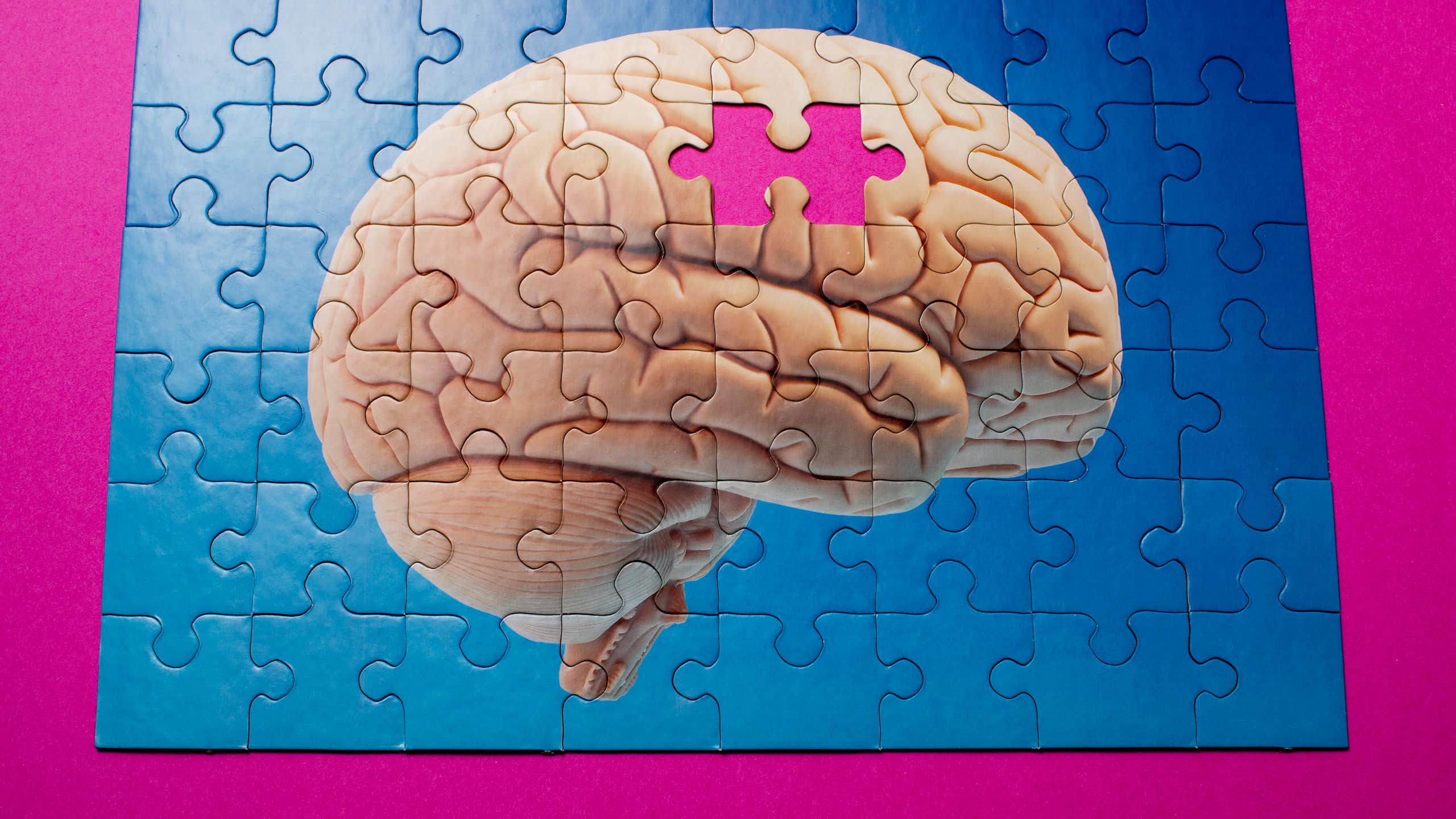 Brain puzzle missing a piece.