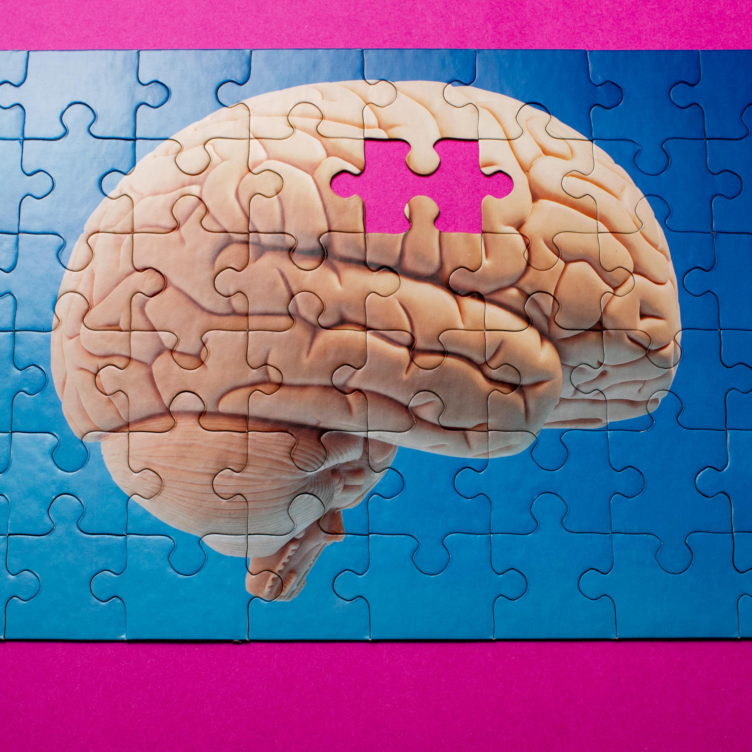 Brain puzzle missing a piece.