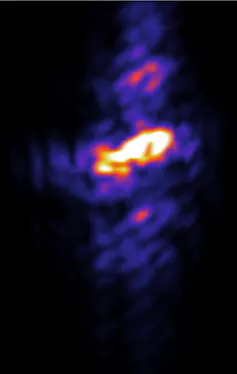 A figure showing several roughly spherical blobs of light, in a line with the largest and brightest in the center.