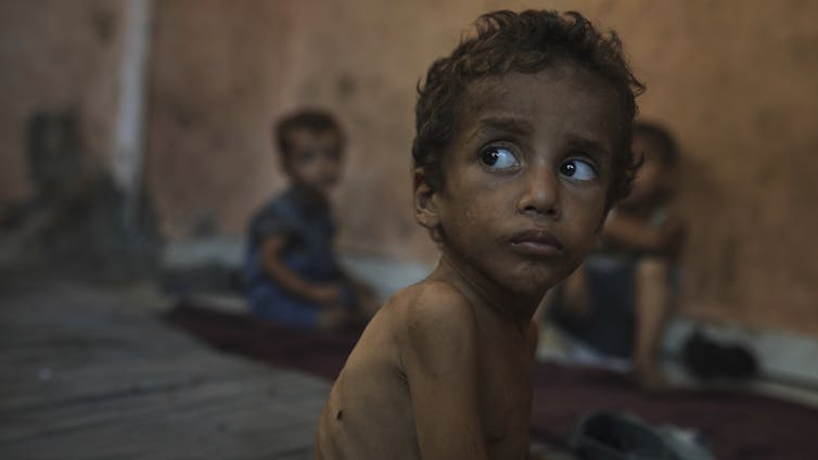 As an Indigenous scholar who studies history, I know that countries have used starvation to conquer Indigenous peoples and acquire their land.