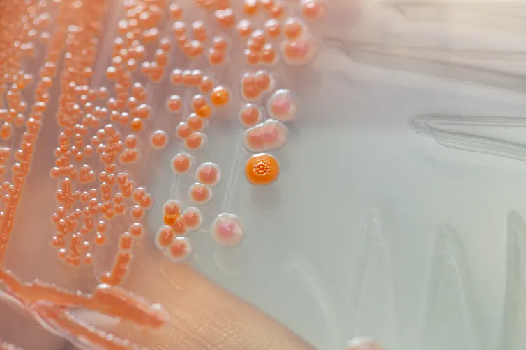 Serratia marcescens