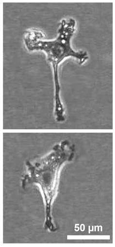 Microfotografías de células de microglía.