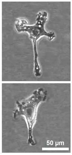 Microfotografías de células de microglía.
