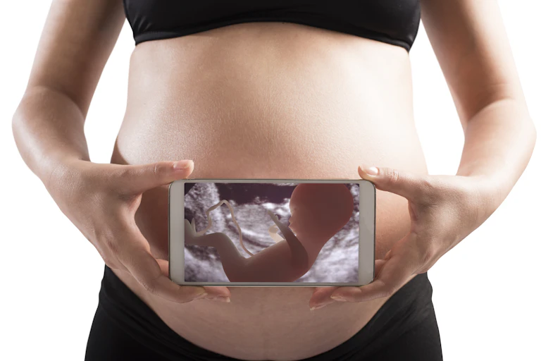 Ultrasound image of a baby on the screen of a cell phone held in front of a pregnant woman's belly.
