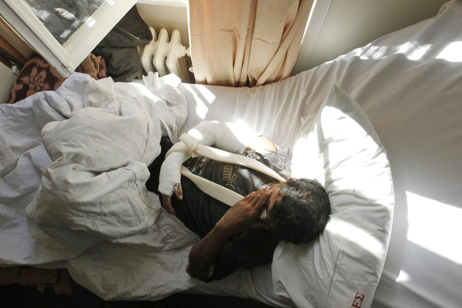 A man with a cast on his arm is lying in bed.