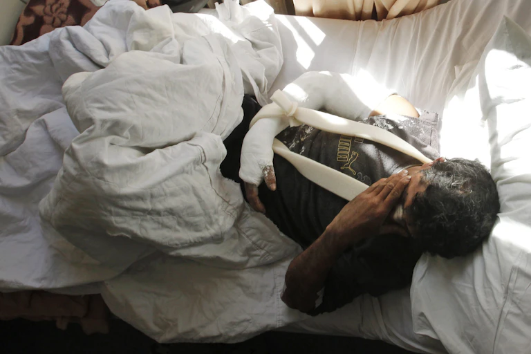 A man with a cast on his arm is lying in bed.