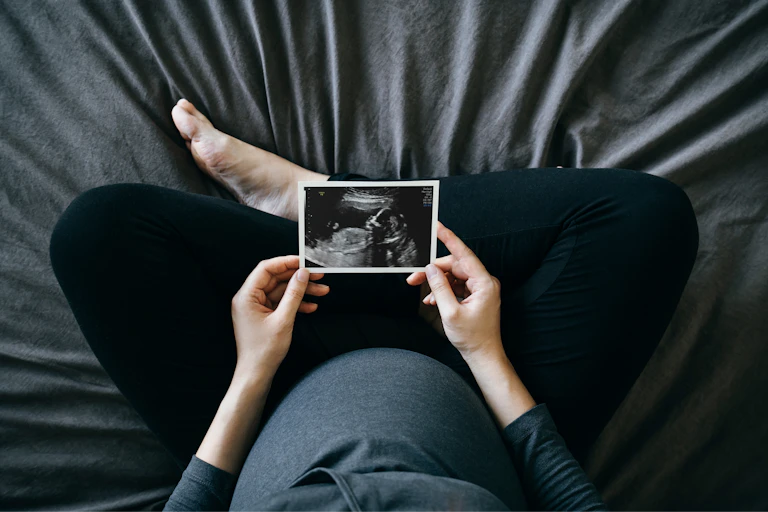 High-angle shot of a pregnant person holding an ultrasound scan photo in front of their baby bump.
