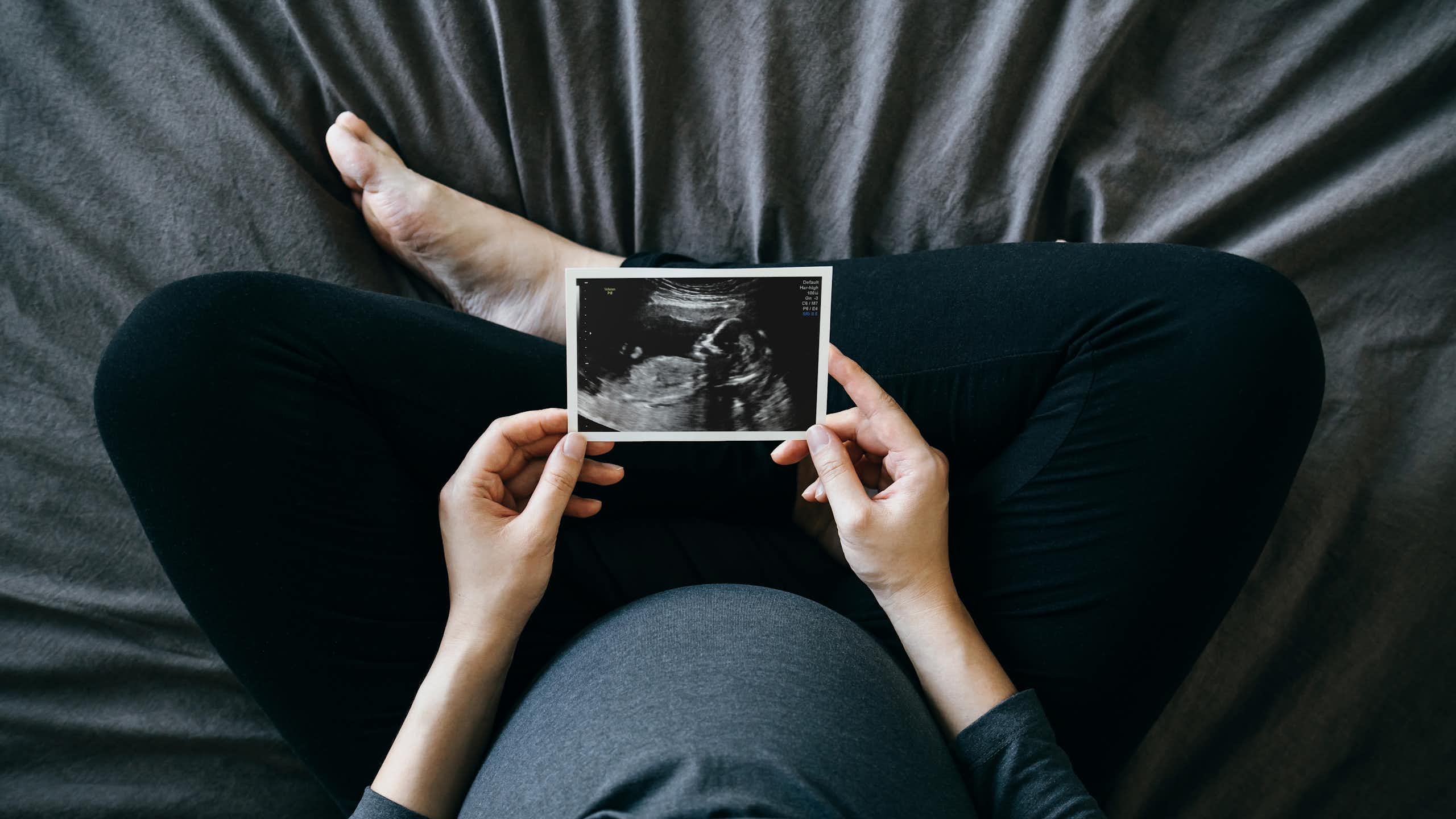 High-angle shot of a pregnant person holding an ultrasound scan photo in front of their baby bump.