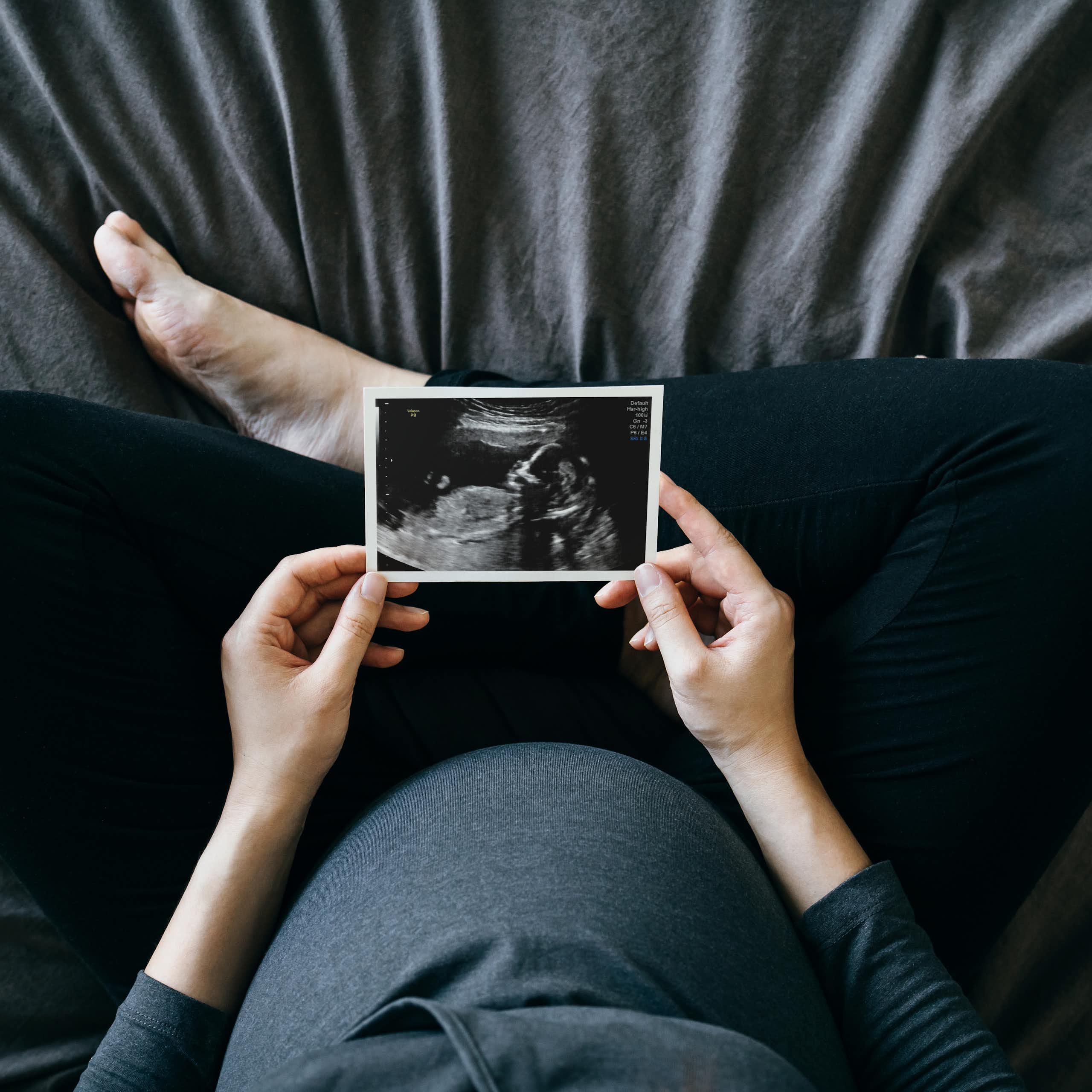 High-angle shot of a pregnant person holding an ultrasound scan photo in front of their baby bump.