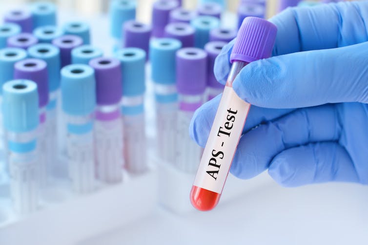 Gloved hand holding a vial of blood used for a blood test, with a collection of vials in the background.