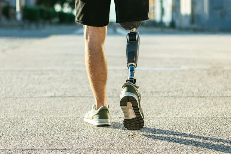 Man's legs showing one prosthetic limb.