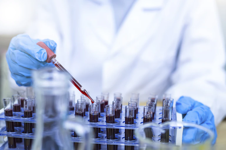 Scientist hand holding test tube with blood in laboratory