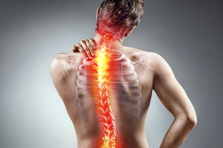A man holds his neck in pain. The vertebrae of his spine are super-imposed on top.