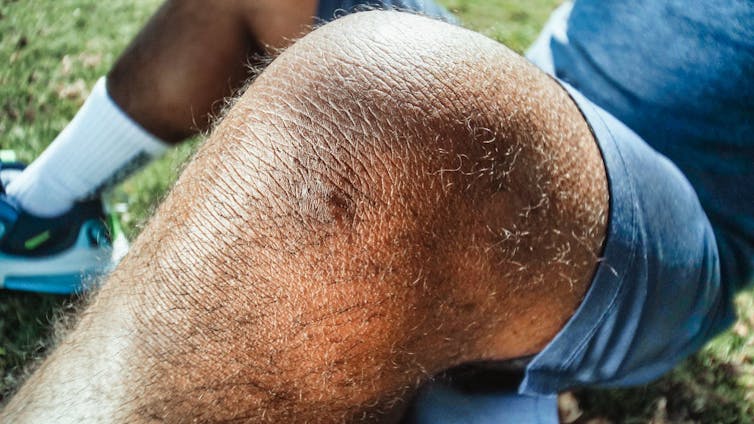 Man sitting on ground, close-up of bare knee.