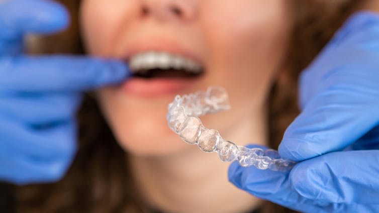 An orthodontist fitting a retainer.