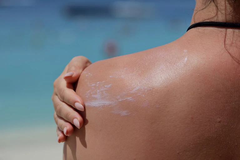 Woman applying sunscreen to her shoulder.