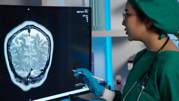 Un chirurgien examine une IRM cérébrale