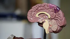 Vue du cerveau humain en plan médian
