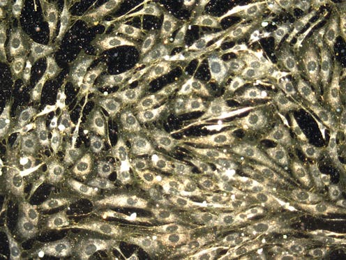 Your immune system attacks drugs like it does viruses – paradoxically offering a way to improve cancer treatment