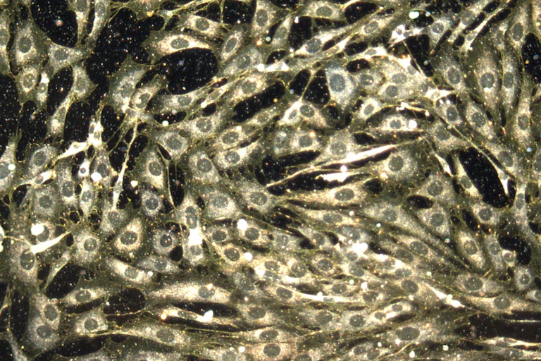 Microscopy image of an array of cells against a black background, yellow dots in the interstices