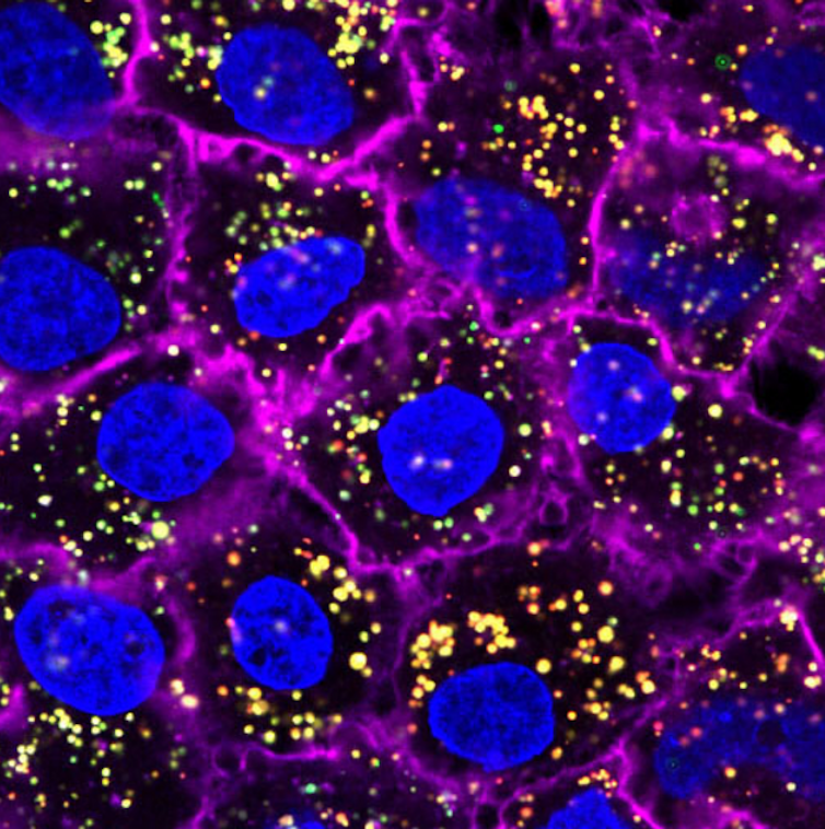 Microscopy image of blue spheres surrounded by magenta borders, many small yellow dots concentrated inside