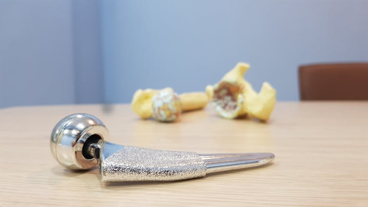 A prosthetic hip joint on a table, with bones in the background showing a worn-out hip socket.
