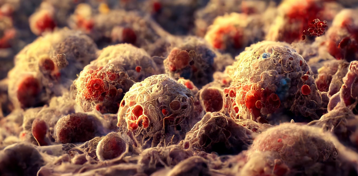 Siete virus que pueden causar cáncer