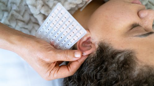 What is ‘ear seeding’, the TikTok trend said to treat stress and fatigue?