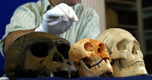 Hobbits of Flores evolved to be small by slowing down growth during childhood, new research on teeth and brain size suggests