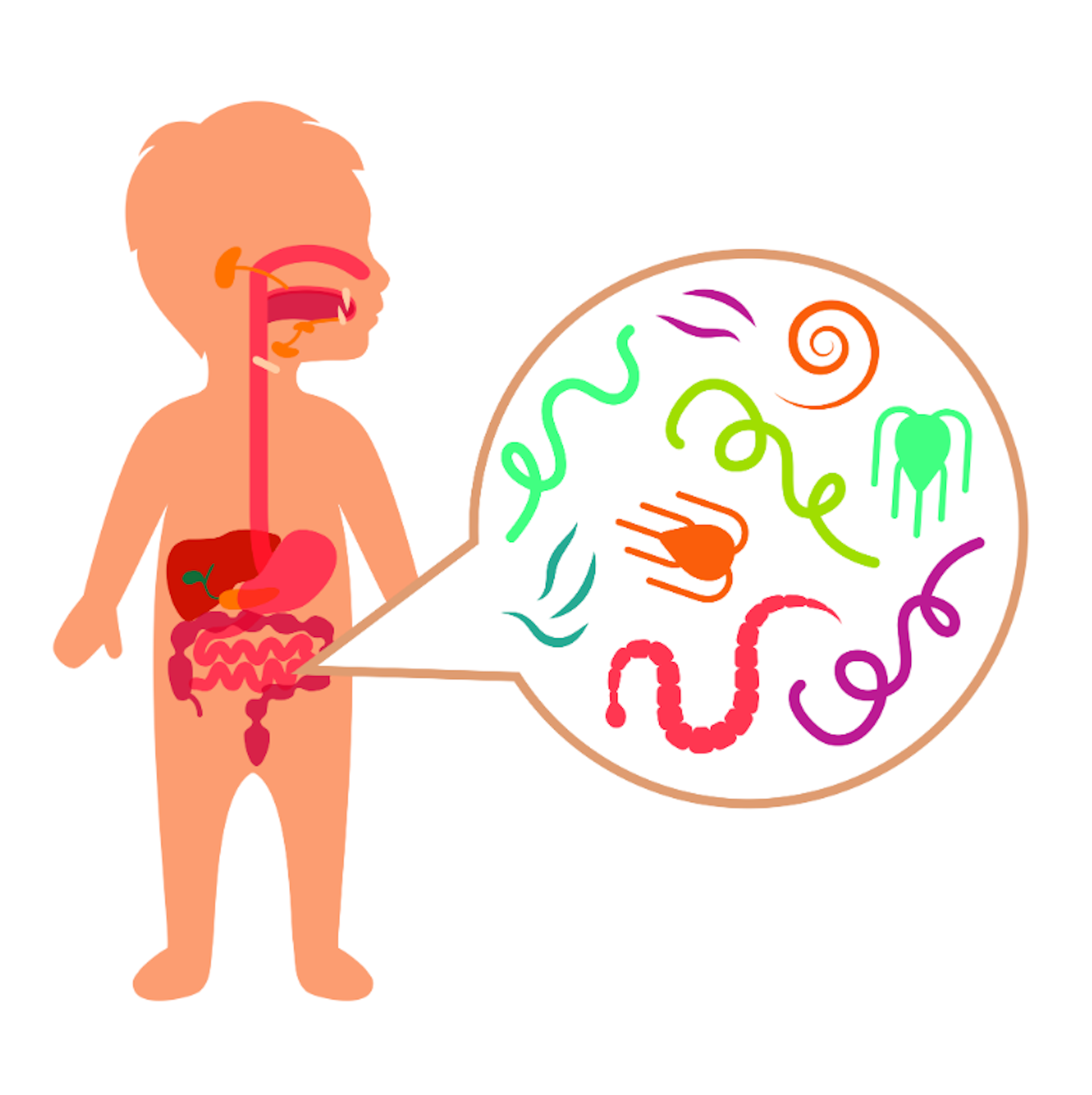 Ilustrasi cacingan yang rentan dialami anak terlantar dengan sanitasi buruk.