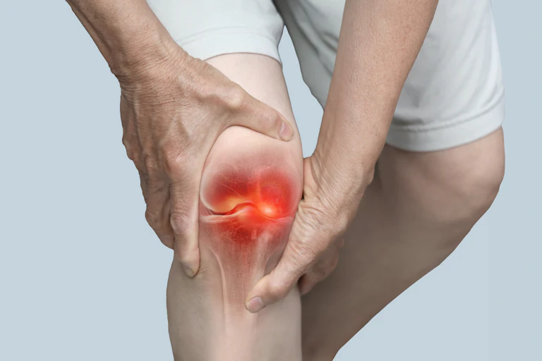 Photograph of a man holding inflamed knee