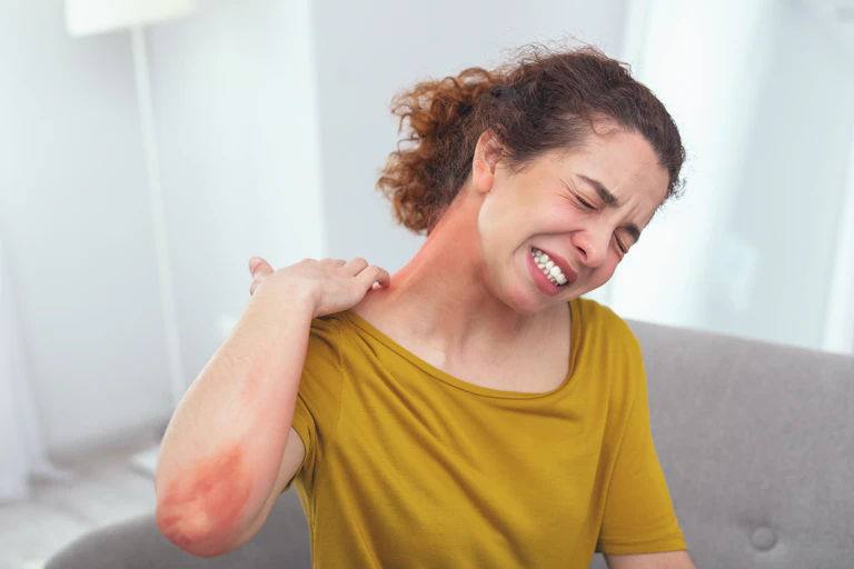 Woman itching painful red rash covering neck and arms