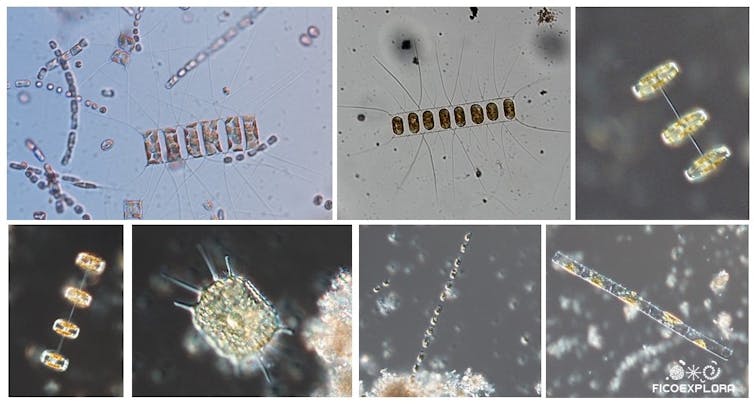 Diatoms, a field of chemical surprises for survival at nighttime 1 file 20250929 56 n22qie.jpg?ixlib=rb 4.1