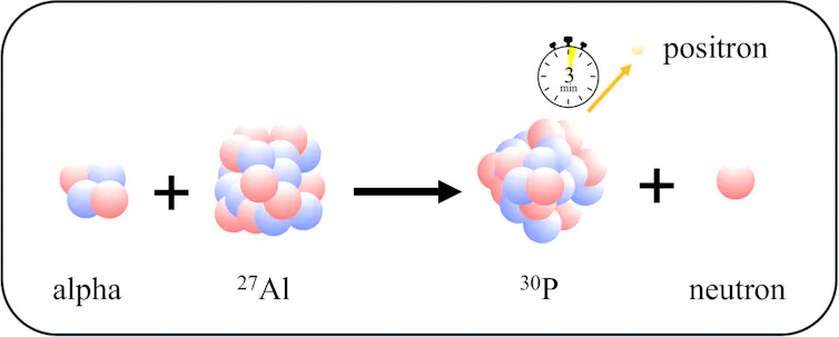 A diagram showing an atom of 27-aluminum next to an alpha which is made of two neutrons and two protons. Next to it is an arrow to a lone neutron and an atom of 30-phosphorus with an arrow labeled 'positron' coming off it.