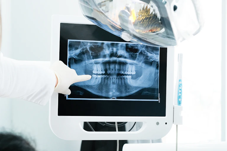 Un dentista señala en una radiografía de la boca.