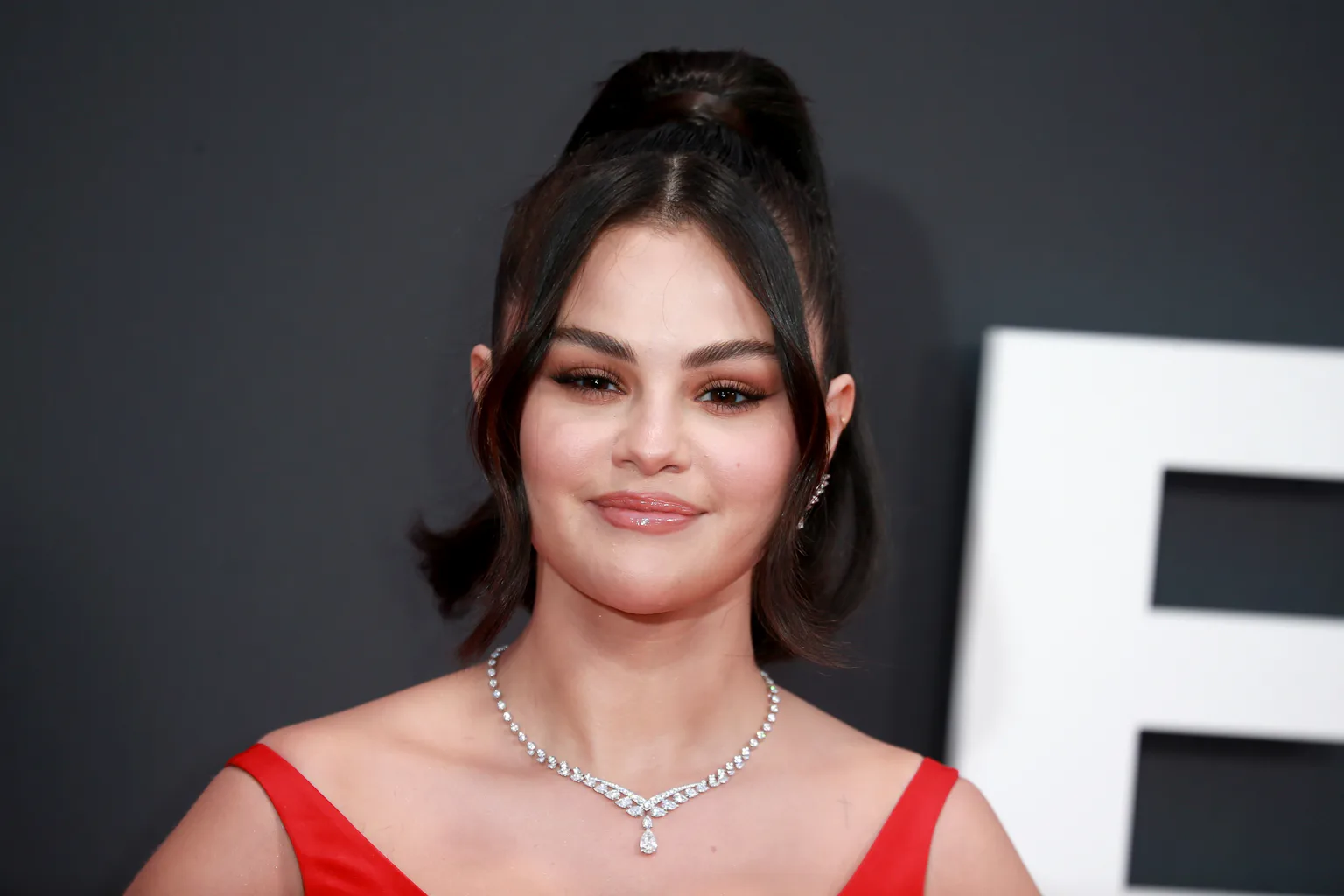 What is lupus, the condition Selena Gomez is diagnosed with?