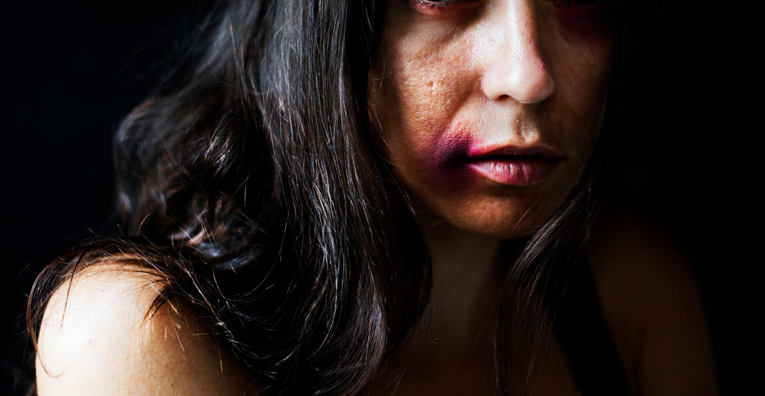 Imobilidade tônica: o que é a resposta instintiva ao estupro que pode causar ainda mais desamparo às vítimas